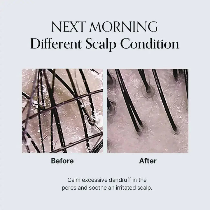 GROWUS Damage Therapy Scalp Ampoule GROWUS