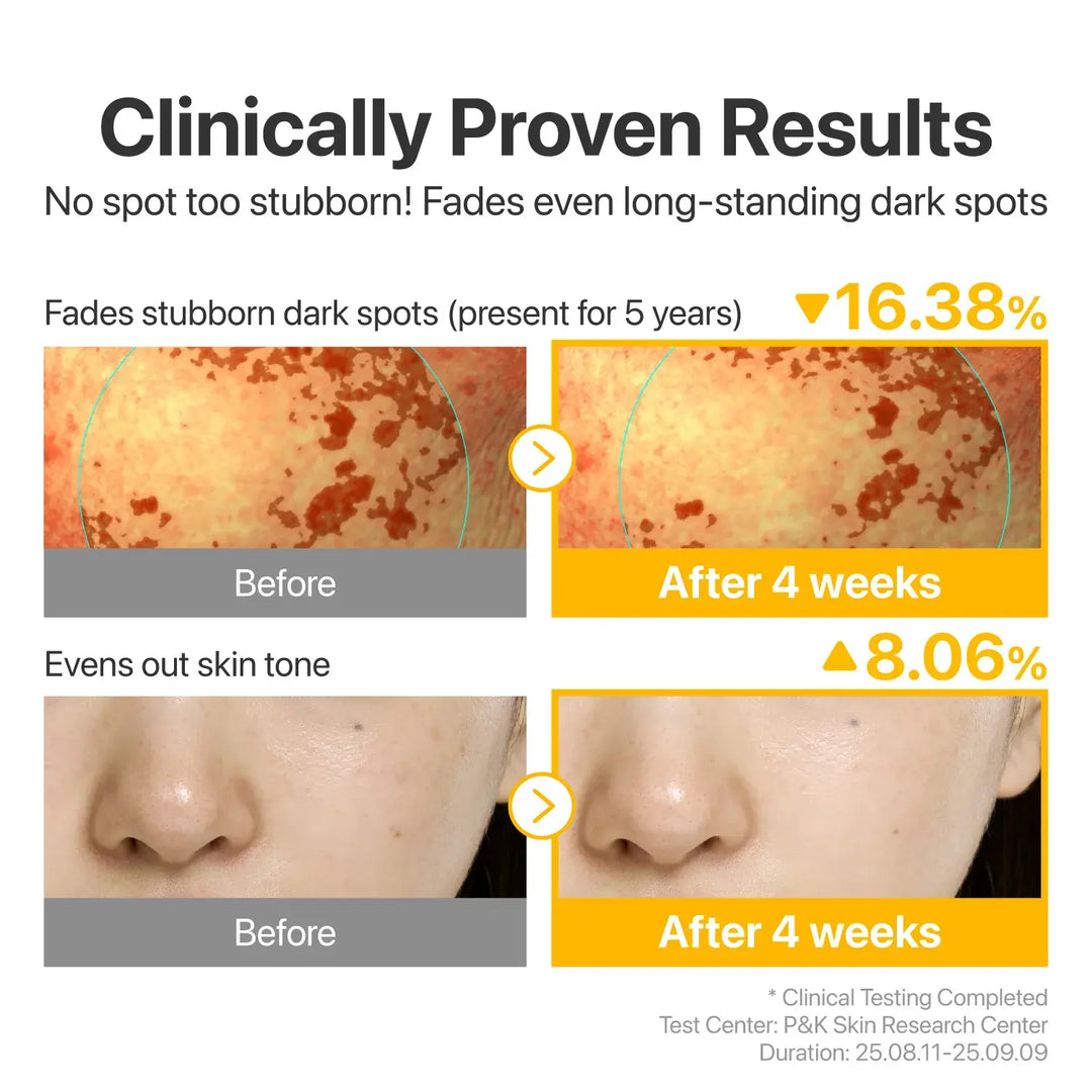 numbuzin No.5 Glutathione TXA Advanced Dark Spot Ampoule Concentrate - Seouléa